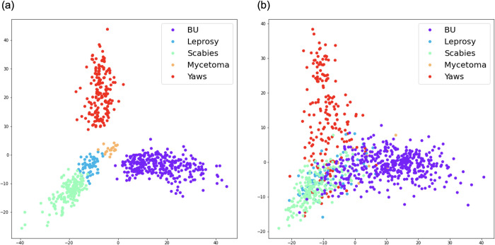 Deep learning for AI-based diagnosis of skin-related neglected tropical diseases: A pilot study.