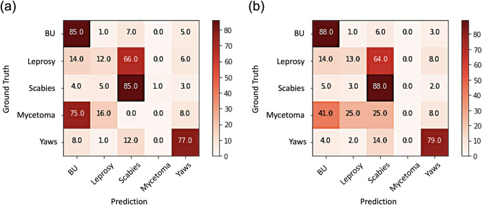 Deep learning for AI-based diagnosis of skin-related neglected tropical diseases: A pilot study.