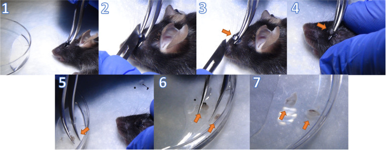 Multi-color Flow Cytometry Protocol to Characterize Myeloid Cells in Mouse Retina Research.