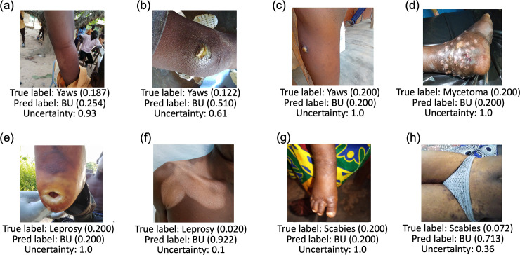 Deep learning for AI-based diagnosis of skin-related neglected tropical diseases: A pilot study.