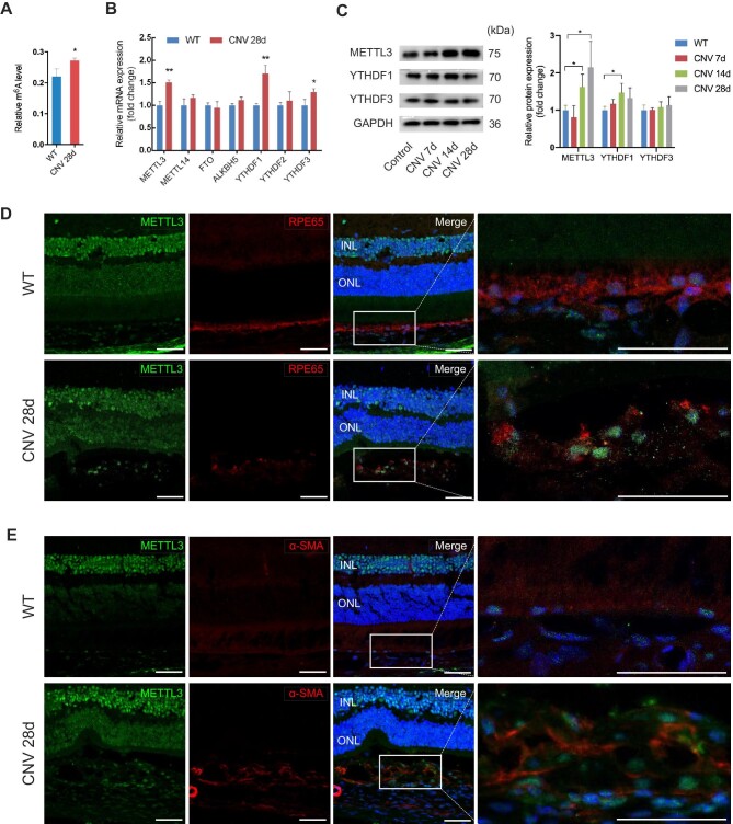 METTL3-mediated m6A modification of HMGA2 mRNA promotes subretinal fibrosis and epithelial-mesenchymal transition.