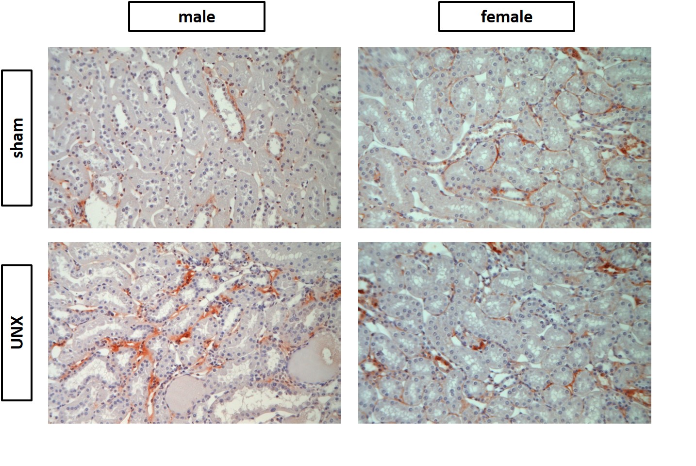 Sex differences in long-term kidney fibrosis following neonatal nephron loss during ongoing nephrogenesis.