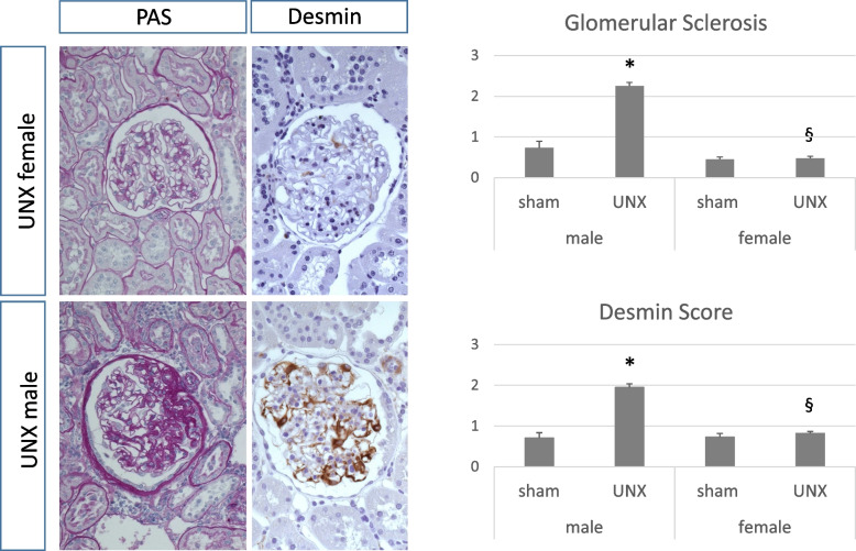 Sex differences in long-term kidney fibrosis following neonatal nephron loss during ongoing nephrogenesis.