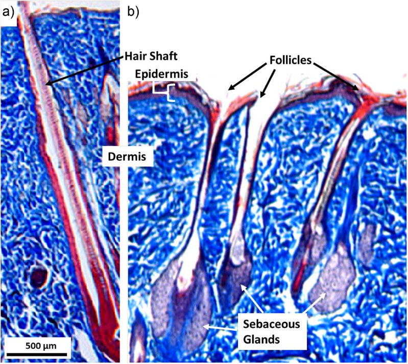 Atmospheric pressure plasma treatment of skin: penetration into hair follicles.