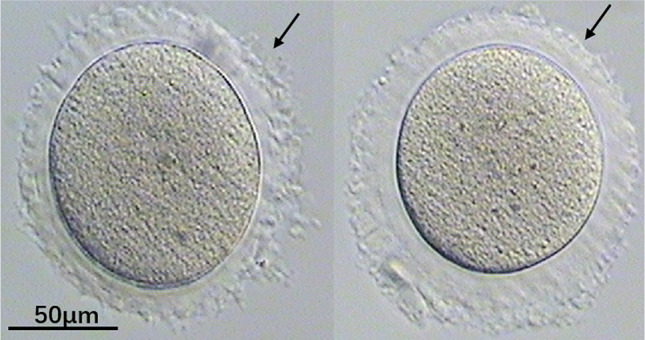 Compare Two Kinds of Recurrent MI-Arrest Oocytes.