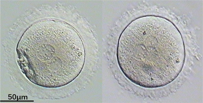 Compare Two Kinds of Recurrent MI-Arrest Oocytes.