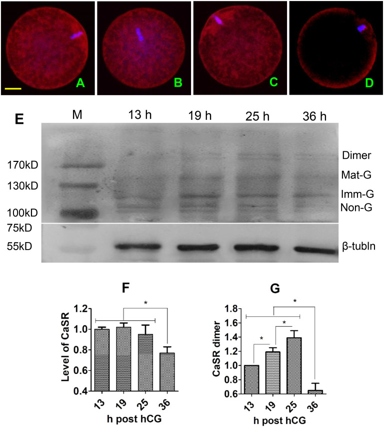 Role of calcium-sensing receptor in regulating activation susceptibility of postovulatory aging mouse oocytes.