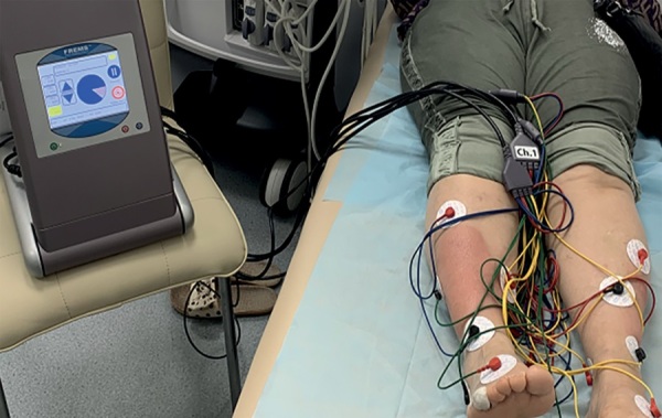 [An integrated approach to the treatment of pretibial myxedema based on pulse therapy with prednisolone and electrical neuromyostimulation (FREMS-therapy) in a patient with Graves' disease and thyroid eye disease].