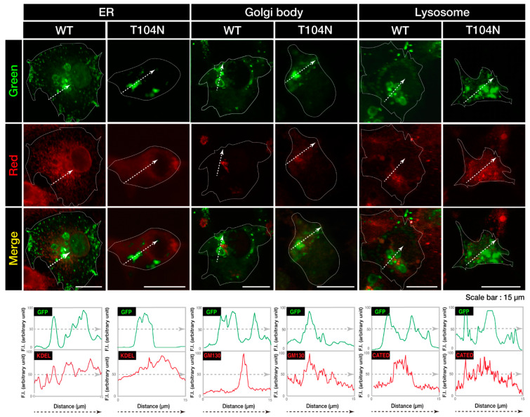 FTD/ALS Type 7-Associated Thr104Asn Mutation of CHMP2B Blunts Neuronal Process Elongation, and Is Recovered by Knockdown of Arf4, the Golgi Stress Regulator.