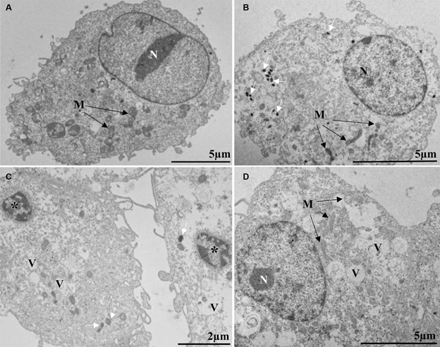 Monkeypox (Mpox) virus isolation and ultrastructural characterisation from a Brazilian human sample case.