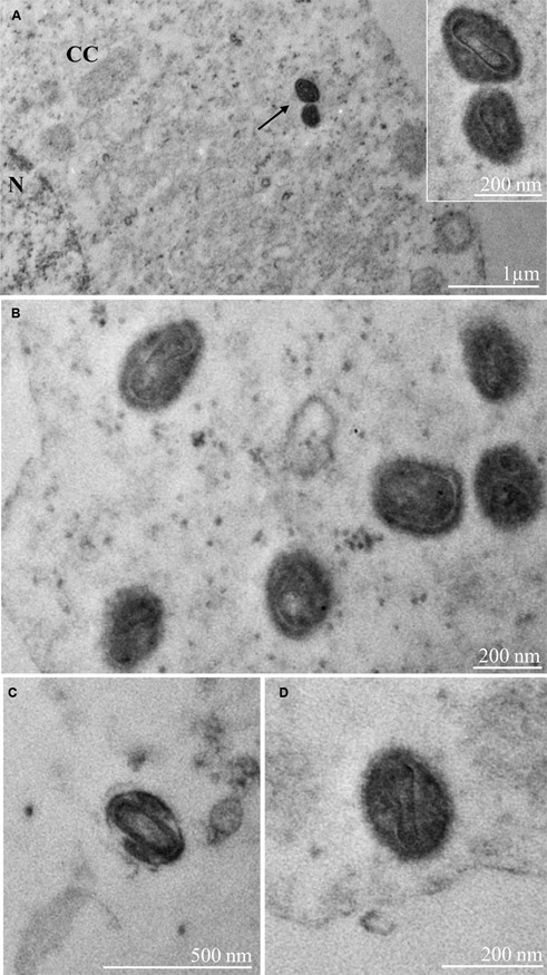 Monkeypox (Mpox) virus isolation and ultrastructural characterisation from a Brazilian human sample case.