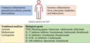 The update of treatment strategies in pediatrics with generalized pustular psoriasis in China.