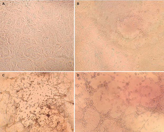 Monkeypox (Mpox) virus isolation and ultrastructural characterisation from a Brazilian human sample case.