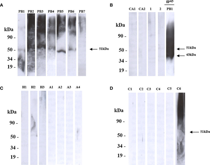 Identification and immunogenic potential of glycosylphosphatidylinositol-anchored proteins in <i>Paracoccidioides brasiliensis</i>.