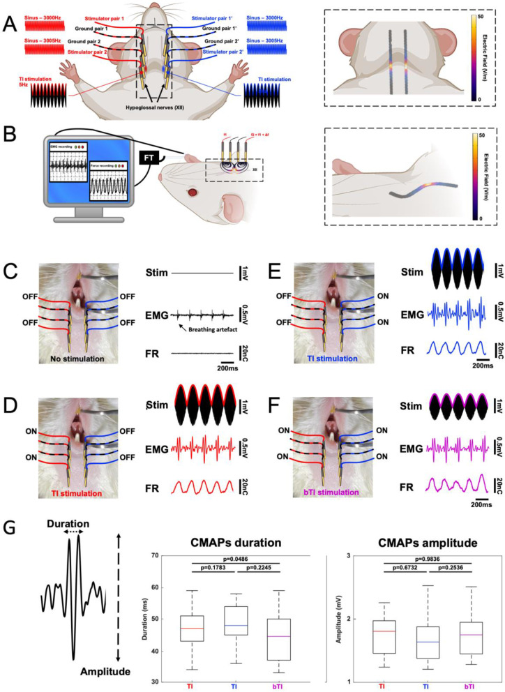 Obstructive sleep apnea improves with non-invasive hypoglossal nerve stimulation using temporal interference.