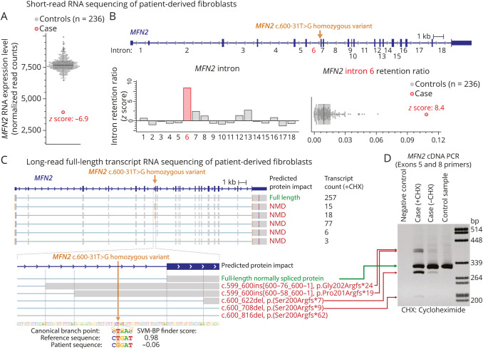 Full-length Isoform Sequencing for Resolving the Molecular Basis of Charcot-Marie-Tooth 2A.