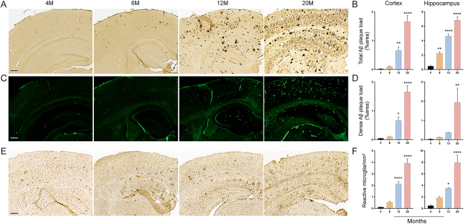 Immune senescence in aged APP/PS1 mice.
