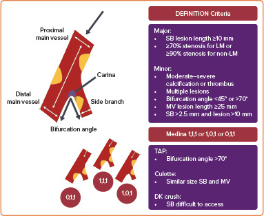 An Approach to Non-left Main Bifurcation Lesions: A Contemporary Review.