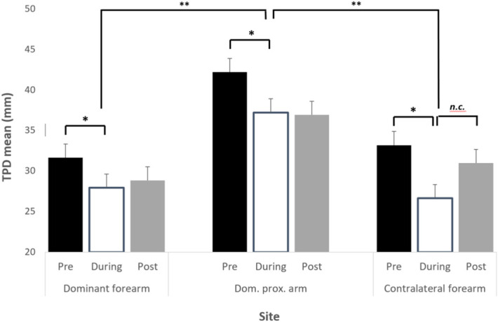 Tactile acuity improves during acute experimental pain of the limb.