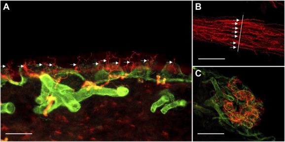 Pain associated with COVID-19 vaccination is unrelated to skin biopsy abnormalities.