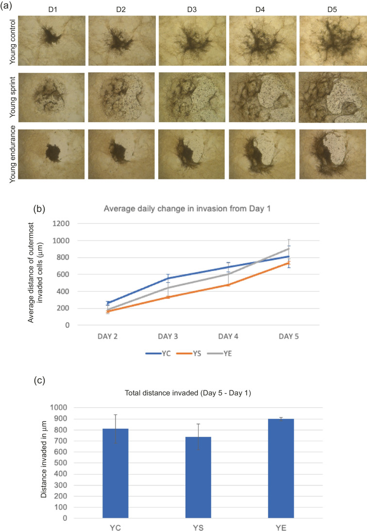 The protective effect of endurance running against the pro-invasive effects of ageing in breast cancer cells and mesenchymal stem cells <i>in vitro</i>.