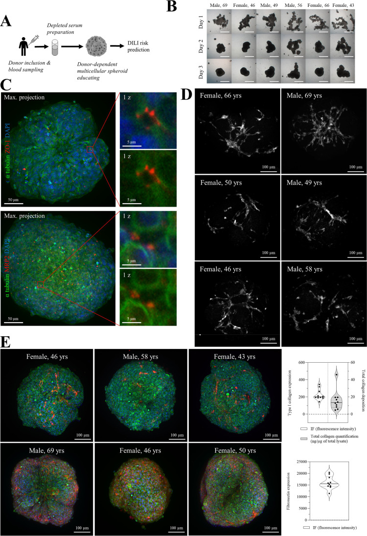 An original donor-dependent spheroid system for the prediction of idiosyncratic drug-induced liver injury risk.
