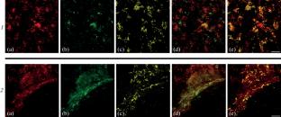 Immunofluorescent Identification of GABAergic Structures in the Somatic Muscle of the Earthworm Lumbricus terrestris