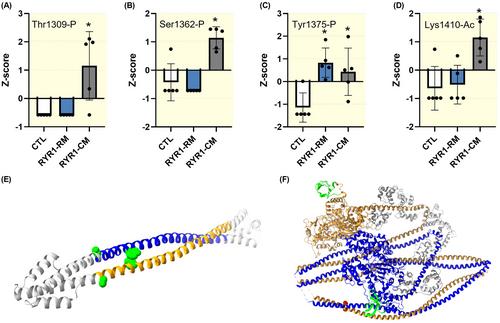 Abnormal myosin post-translational modifications and ATP turnover time associated with human congenital myopathy-related RYR1 mutations