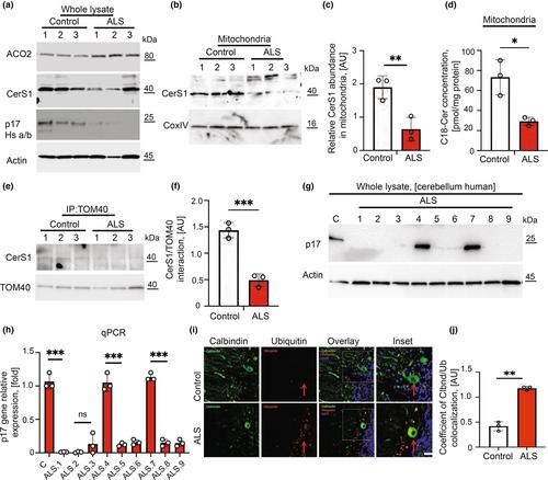 Alterations of lipid-mediated mitophagy result in aging-dependent sensorimotor defects