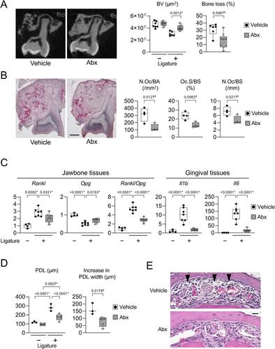 Osteocyte RANKL Drives Bone Resorption in Mouse Ligature-Induced Periodontitis