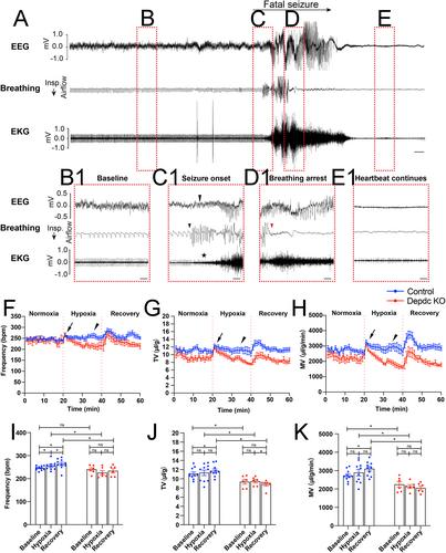 Sudden Unexpected Death in Epilepsy and Respiratory Defects in a Mouse Model of DEPDC5-Related Epilepsy