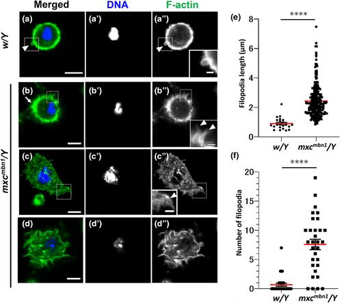 Ectopic expression of matrix metalloproteinases and filopodia extension via JNK activation are involved in the invasion of blood tumor cells in Drosophila mxc mutant