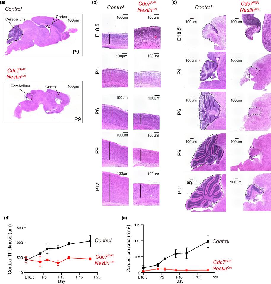 Cdc7 kinase is required for postnatal brain development