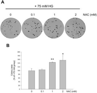 Prolonged Exposure to High Glucose Induces Premature Senescence Through Oxidative Stress and Autophagy in Retinal Pigment Epithelial Cells