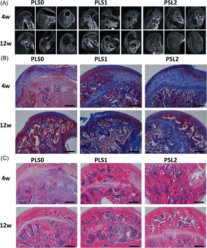 Recent progress in thermosensitive hydrogels and their applications in drug delivery area