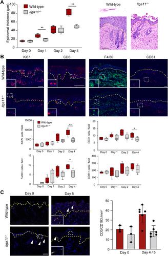 Forward genetics and functional analysis highlight Itga11 as a modulator of murine psoriasiform dermatitis