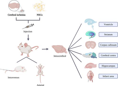 Routes and methods of neural stem cells injection in cerebral ischemia