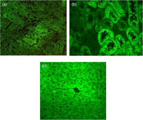 Analysis of null deletion polymorphism of glutathione S-transferase theta (GSTT-1), associated with anti-GSTT-1 antibodies development in transplantation