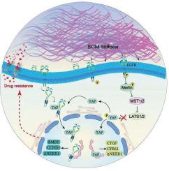 Extracellular cell matrix stiffness-driven drug resistance of breast cancer cells via EGFR activation