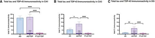 Distinct Patterns of Hippocampal Pathology in Alzheimer's Disease with Transactive Response DNA-binding Protein 43