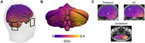 Cerebellar Modulation of Sensorimotor Associative Plasticity Is Impaired in Cervical Dystonia