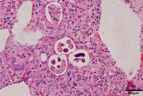 Lung worm (Marsupostrongylus spp.) infection in common brushtail possums (Trichosurus vulpecula)