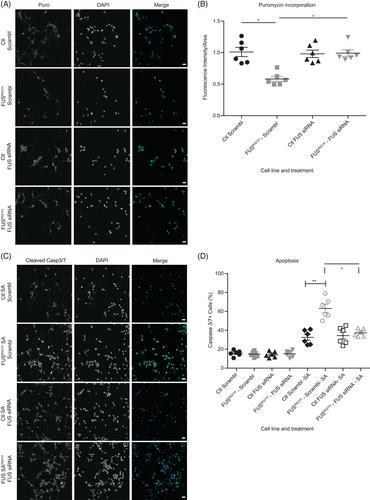 IFNγ protects motor neurons from oxidative stress via enhanced global protein synthesis in FUS-associated amyotrophic lateral sclerosis