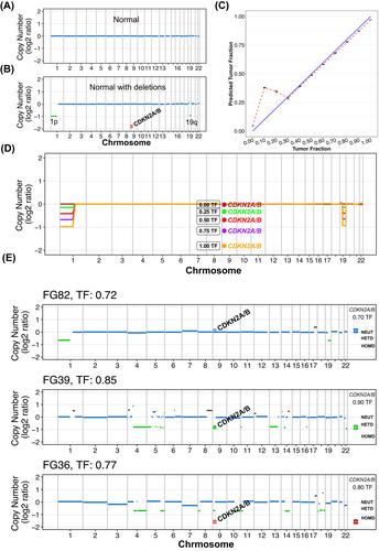 Exploiting nanopore sequencing for characterization and grading of IDH-mutant gliomas