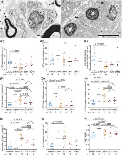 Myelin protein zero mutation-related hereditary neuropathies: Neuropathological insight from a new nerve biopsy cohort