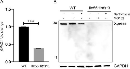 GNAO1 Haploinsufficiency: The Milder End of the GNAO1 Phenotypic Spectrum