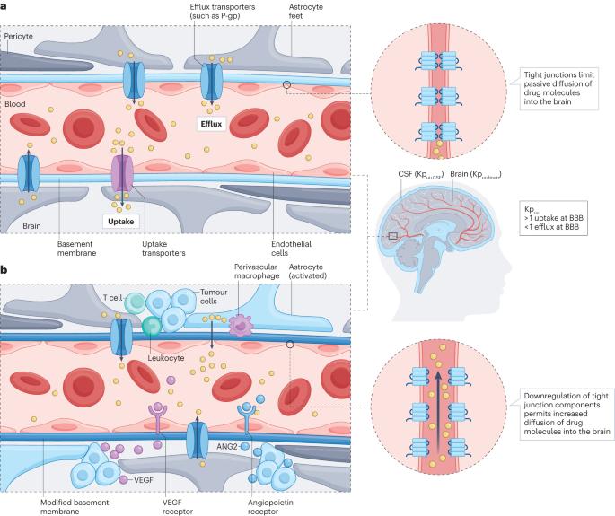 Emerging therapeutics and evolving assessment criteria for intracranial metastases in patients with oncogene-driven non-small-cell lung cancer