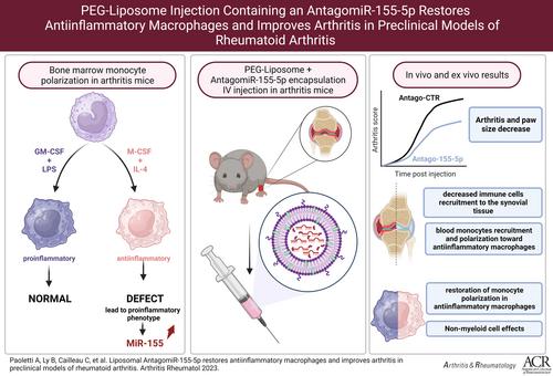 Liposomal AntagomiR-155-5p Restores Anti-Inflammatory Macrophages and Improves Arthritis in Preclinical Models of Rheumatoid Arthritis