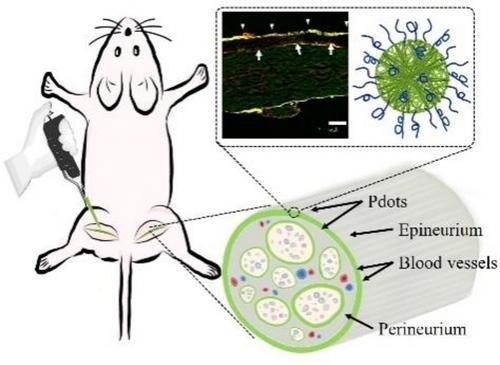 Rapid Peripheral Nerve Imaging by Fluorescent Polymer Dots for Minimizing the Risk of Intraoperative Nerve Injury