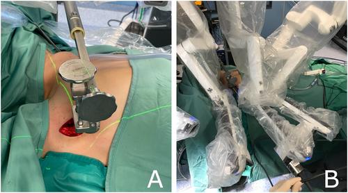 Robot-assisted transaxillary surgery for thyroid cancer: Oncologic and surgical outcomes in long term follow-up